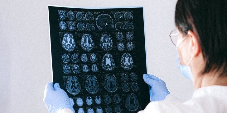 What is Chronic Traumatic Encephalopathy (CTE)?